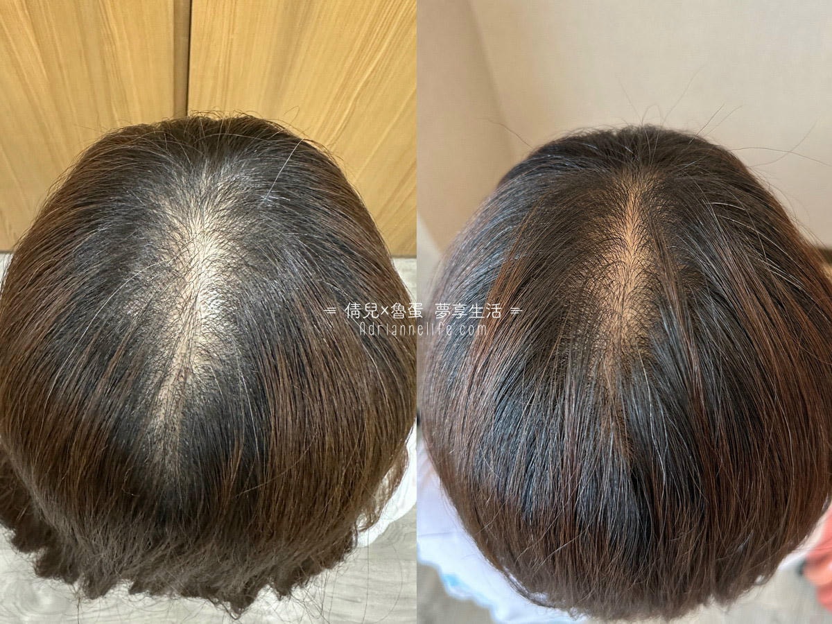 【團購最低價】髮基因Scalp Recovery 經典沙龍系列(橘瓶) 最低75折再送下單及滿額禮！ (至1/13 23:59止) 打造健康頭皮及豐盈秀髮